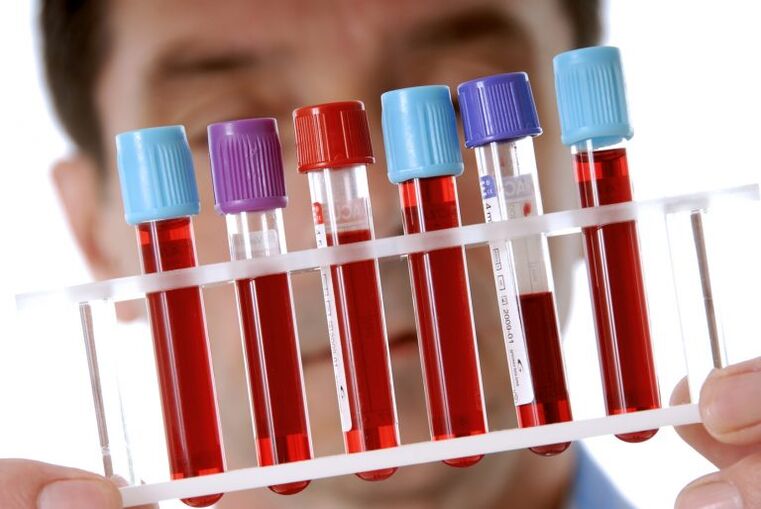 Blood test for the diagnosis of helminthiases